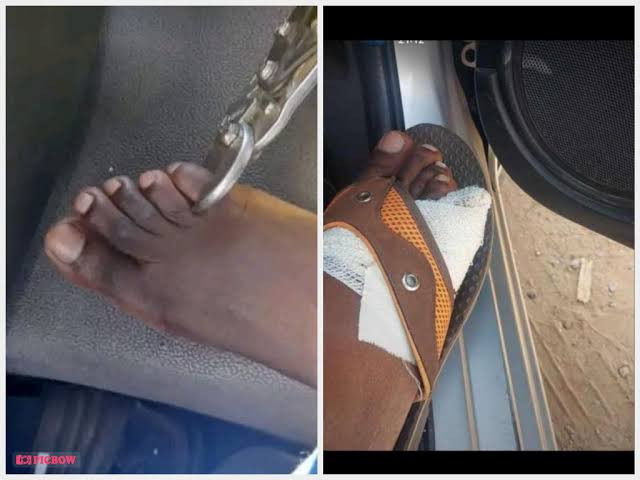 See what Zimbabweans are doing to their toes